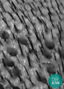 Wypadające włosy - szczotka