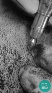 Wypadające włosy - szczotka